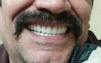Premier Dentures image 4